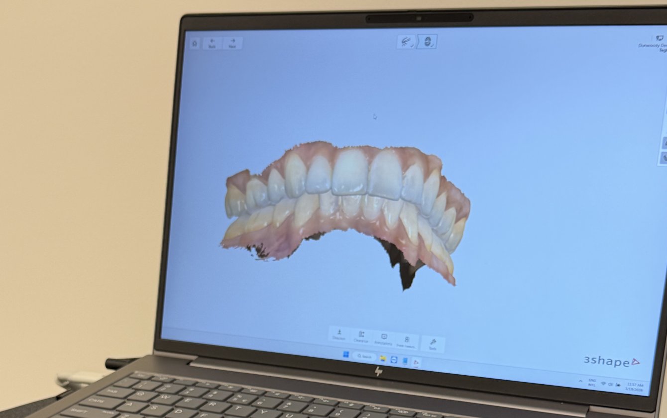 3D digital scan of teeth using advanced dental imaging at Dunwoody Dental Health